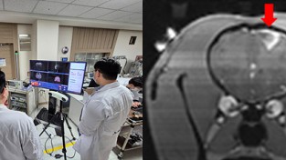 케이메디허브–㈜뉴로소나, 국산기기 최초 대동물 뇌혈관장벽 개방 성공